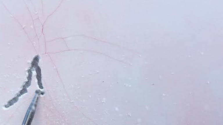 how to repair spider web cracks in fiberglass